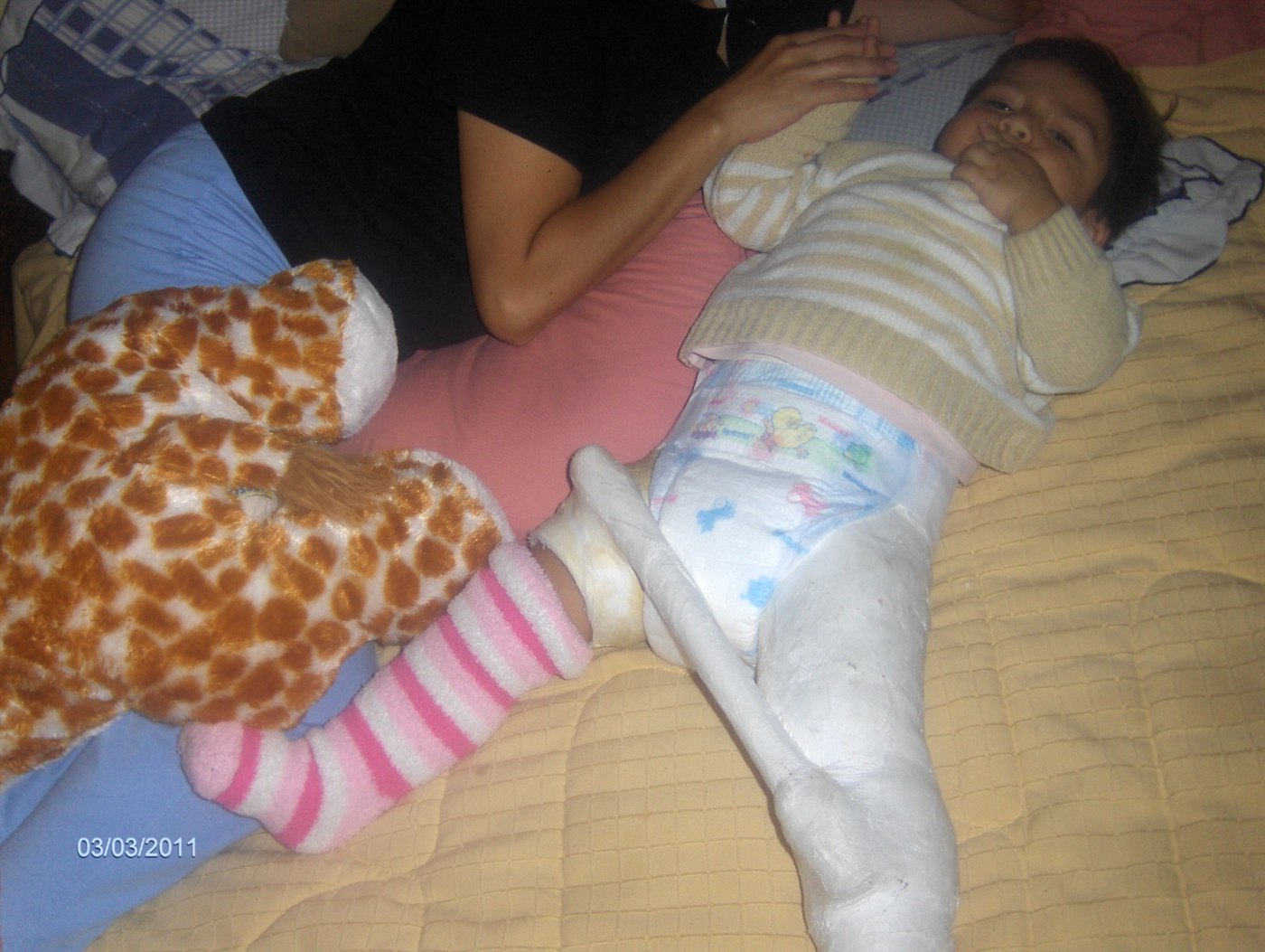 Gustavo Jr. de niño durante una recuperación con yeso